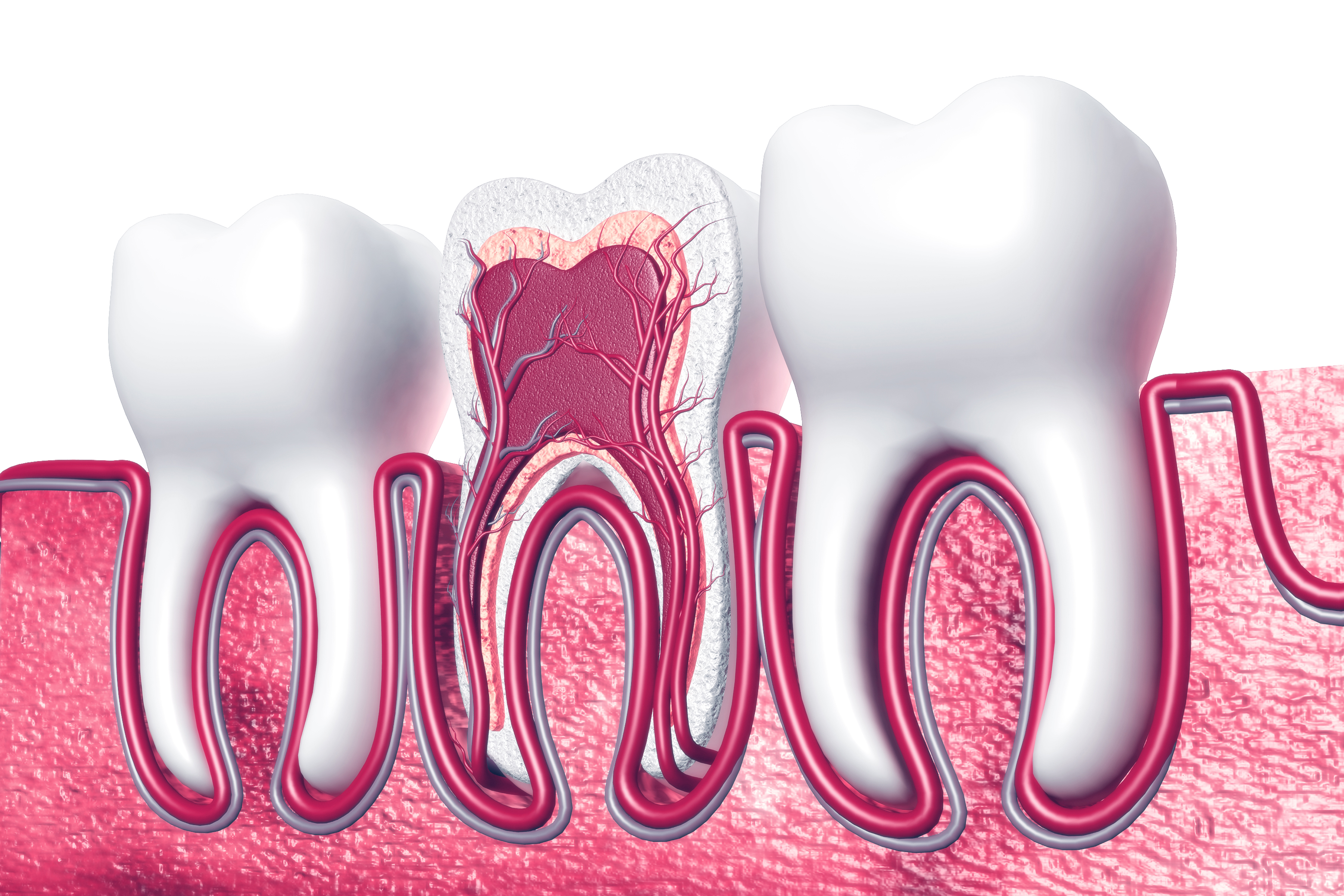 Wisdom tooth nerve pain