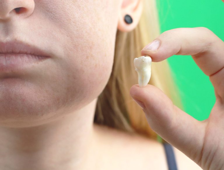 Does Your Face Get Thinner After Wisdom Teeth Removal?
