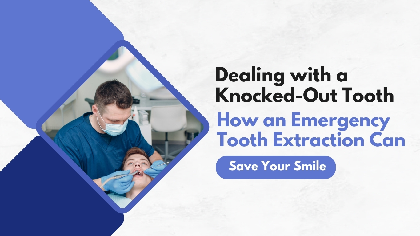 Emergency Teeth Extraction