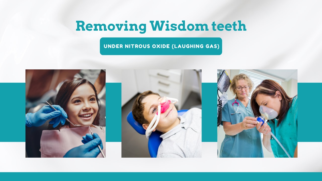 Wisdom Teeth Removal Under Laughing gas