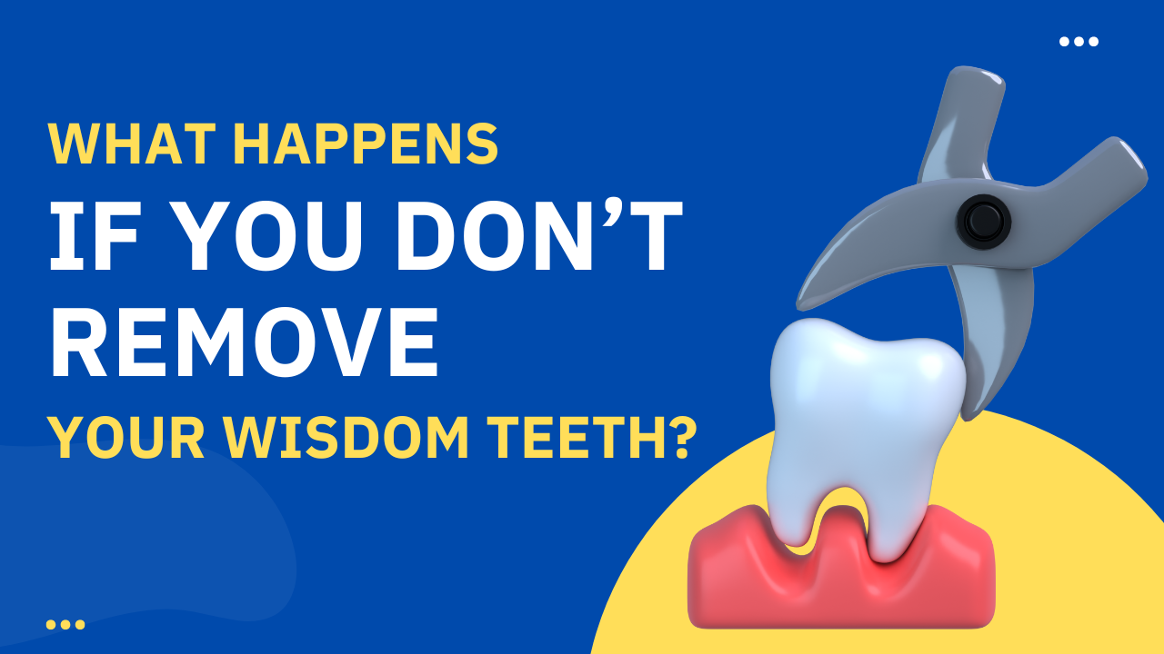 What happens If you don't remove your wisdom teeth