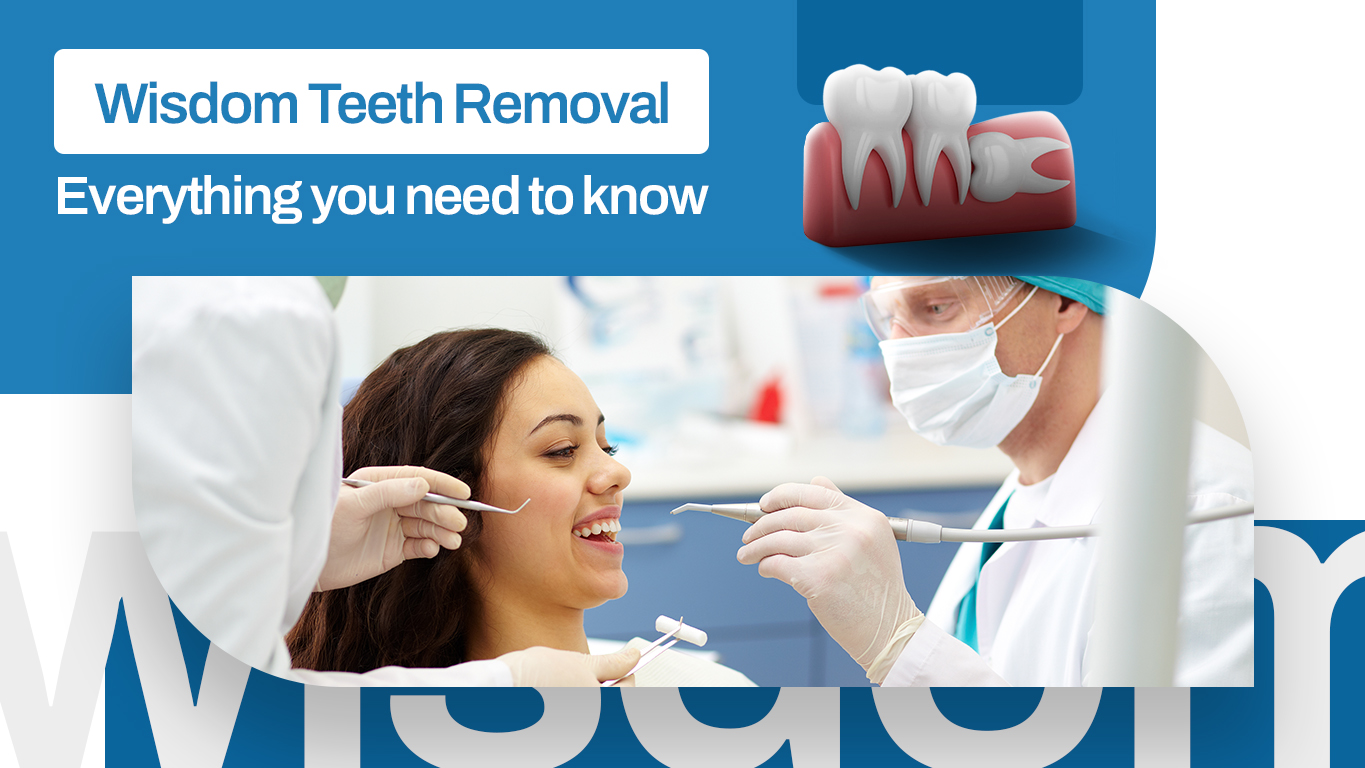 Everything you need to know