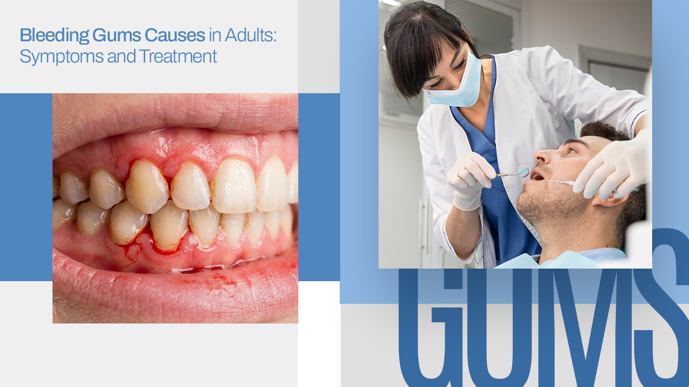 Bleeding Gums Causes