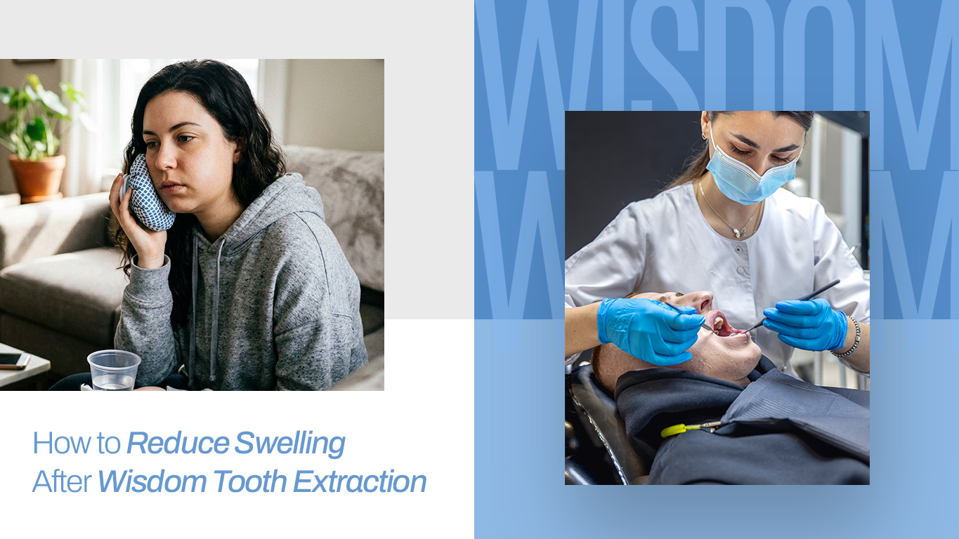 Swelling after Wisdom Tooth Extraction​