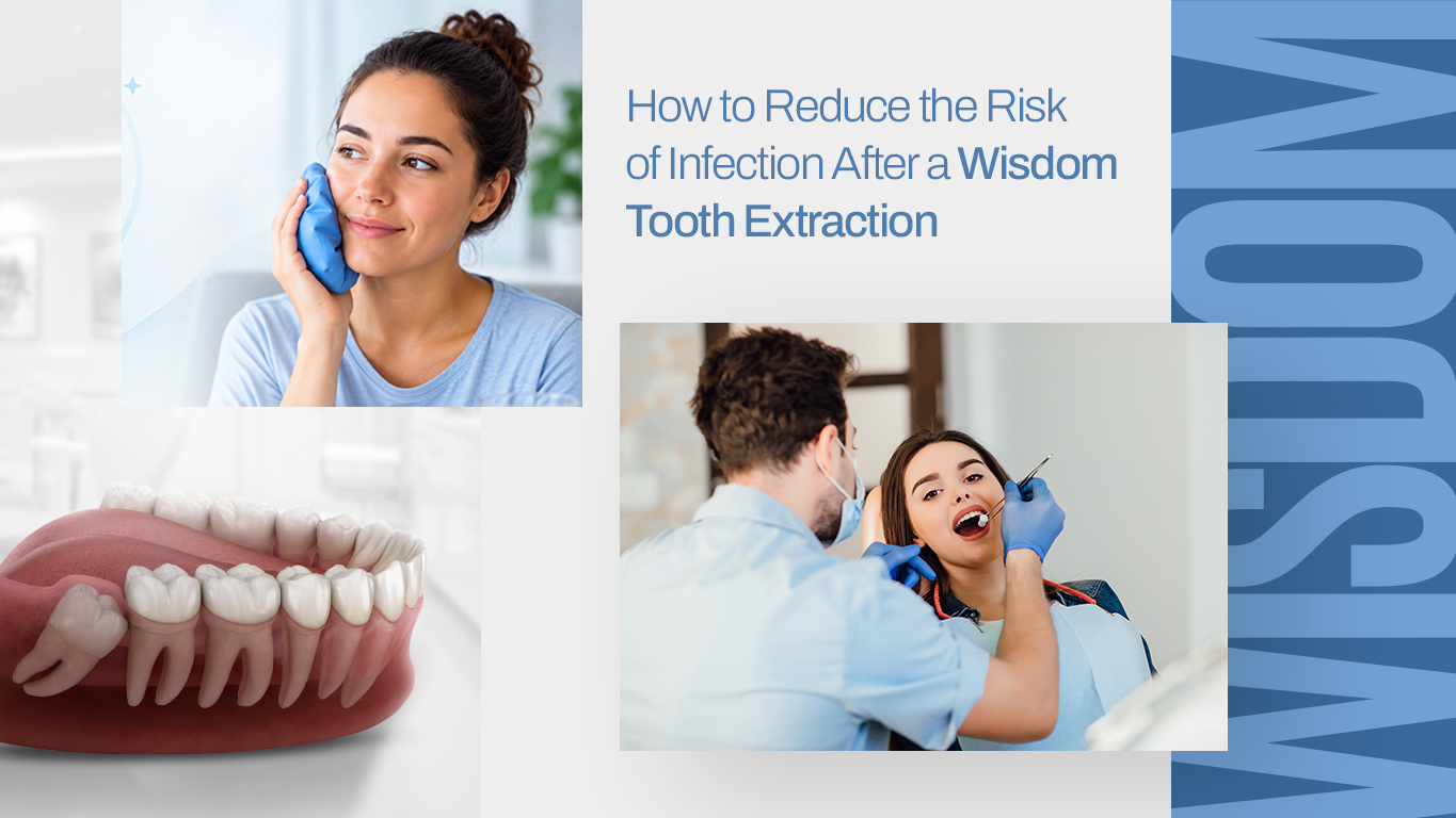 Reduce the Risk of Infection After a Wisdom Tooth Extraction