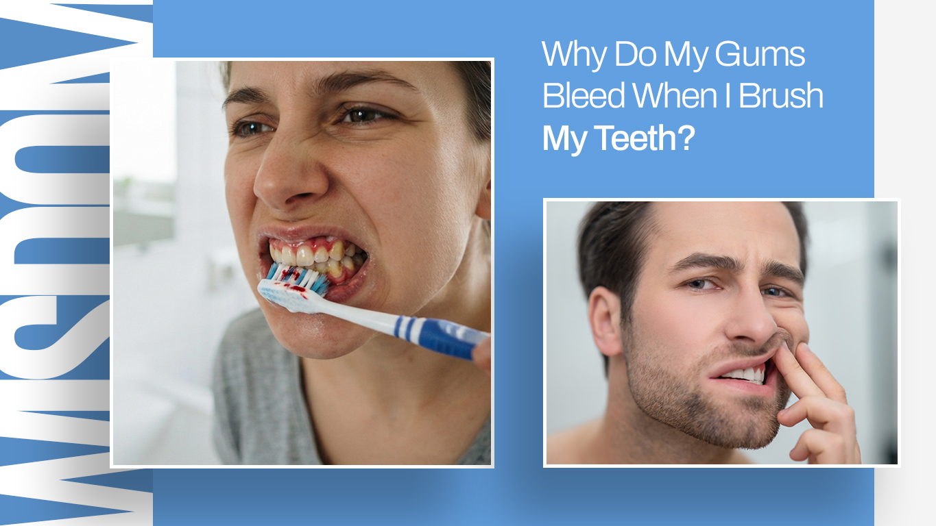 Why Do My Gums Bleed When I Brush My Teeth?