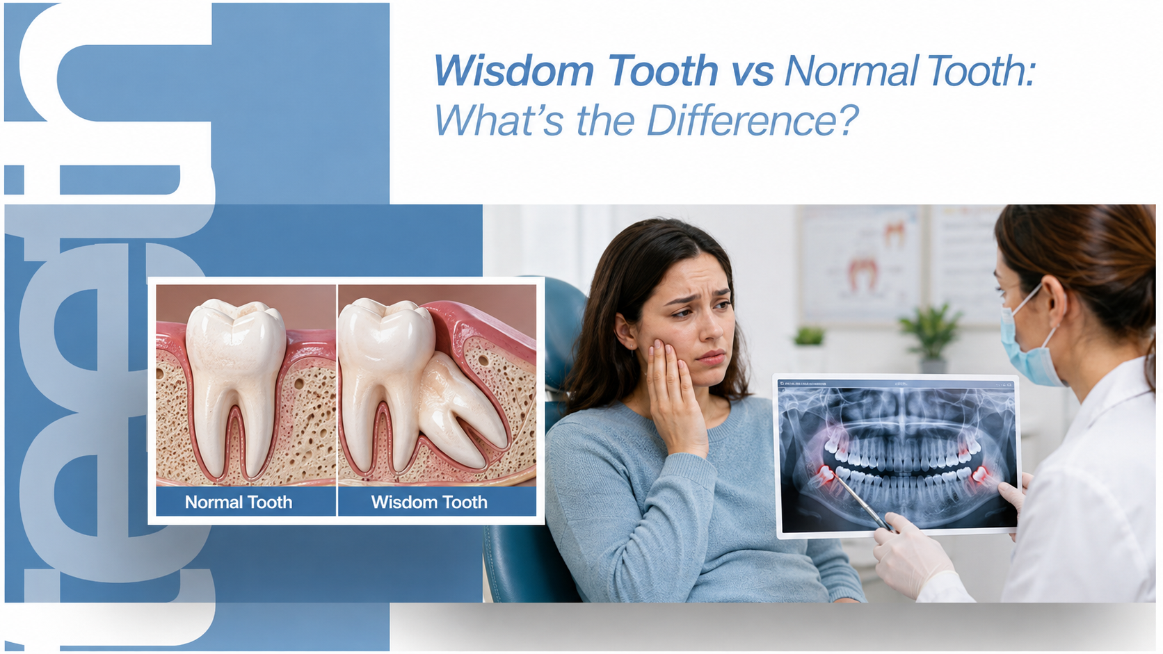 Diagram comparing a wisdom tooth and a normal molar showing root shape and position in the jaw